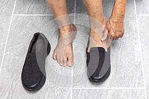 Elderly woman varicose veins feet puts on a shoes