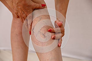 An elderly woman in white panties is touching her legs with cellulite and varicose veins on a light isolated background.