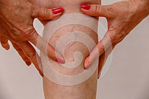 An elderly woman in white panties is touching her legs with cellulite and varicose veins on a light isolated background.