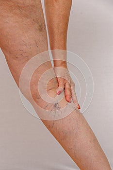 An elderly woman in white panties is touching her legs with cellulite and varicose veins on a light isolated background.