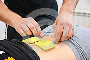 Electric muscle stimulator on woman's back, physiotherapy, rehabilitation.