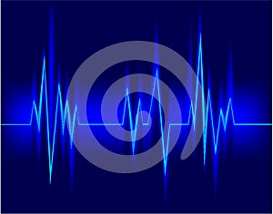 Electrocardiogram