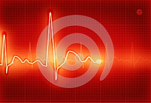 Electrocardiogram photo