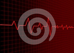 Electrocardiogram