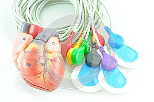 Electrocardiogram