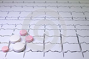 Electrocardiogram with Brugada syndrome. Colored pills on an EKG path. Sudden cardiac death due to arrhythmias