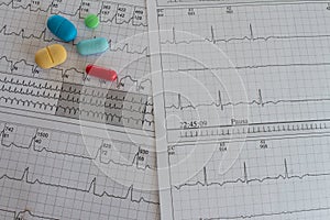 Electrocardiogram with cardiac arrhythmia. Medications for arrhythmia treatments