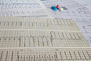 Electrocardiogram with cardiac arrhythmia. Medications for arrhythmia treatments