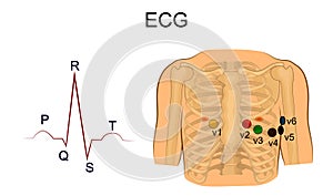 Electrocardiogram. Chest leads