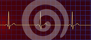 Electrocardiogram ECG displaying sinus bradycardia, 3D illustration photo