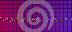 Electrocardiogram ECG displaying ventricular fibrillation rhythm, 3D illustration