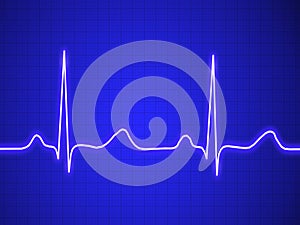 Electrocardiogram, ecg, graph, pulse tracing