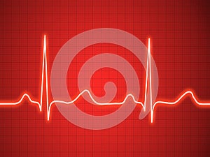 Electrocardiogram, ecg, graph, pulse tracing