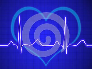 Electrocardiogram, ecg, graph, pulse tracing