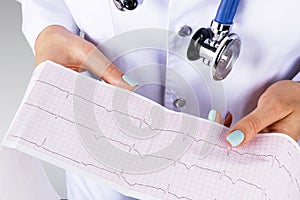 Electrocardiogram, ecg in hand of a female doctor. Medical health care. Clinic cardiology heart rhythm and pulse test closeup.