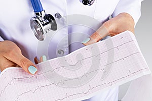 Electrocardiogram, ecg in hand of a female doctor. Medical health care. Clinic cardiology heart rhythm and pulse test closeup.