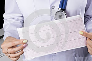 Electrocardiogram, ecg in hand of a female doctor. Medical health care. Clinic cardiology heart rhythm and pulse test closeup. Car