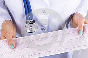 Electrocardiogram, ecg in hand of a female doctor. Medical health care. Clinic cardiology heart rhythm and pulse test closeup. Car