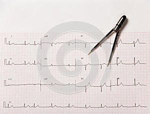 Electrocardiogram, or EKG, With Calipers