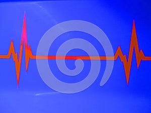 Electrocardiogram EKG photo