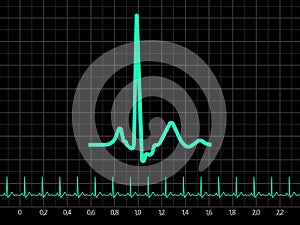 Electrocardiogram (EKG). EPS 8