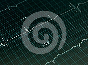 Electrocardiogram graph