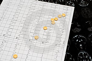 Electrocardiogram graph ECG, heart analysis. Imaging of the br