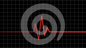 Electrocardiogram. Heartbeat waves
