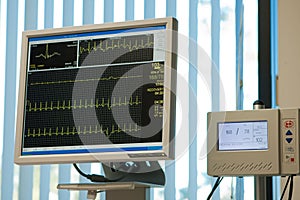 Electrocardiogram monitor and blood pressure