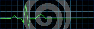 Electrocardiogram Showing Last Heart Beat