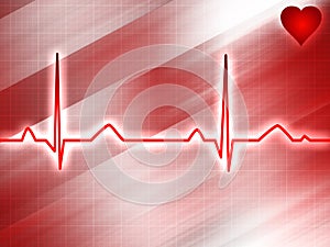 Electrocardiogram track photo