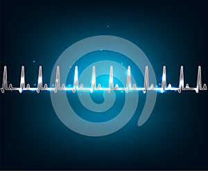 Electrocardiogram photo