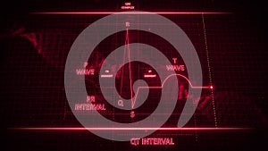 Electrocardiogram Wave or ECG or EKG