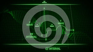 Electrocardiogram Wave or ECG or EKG