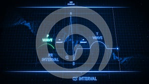 Electrocardiogram Wave or ECG or EKG with P wave