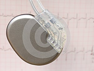 Electrocardiograph with pacemaker photo