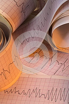 Electrocardiograph Test Results - Cardiac Arrhythmia
