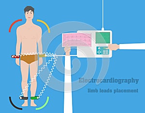 Electrocardiography vector concept. ECG limb leads flat illustration