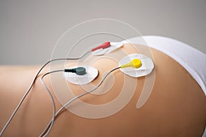 Electrode Muscle Stimulation Therapy