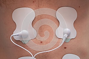 Electrodes for electric stimulator on man abs muscles. Lipomassage on man