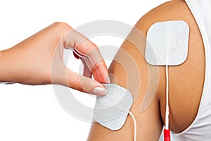 Electrodes of tens device on shoulder, tens therapy,