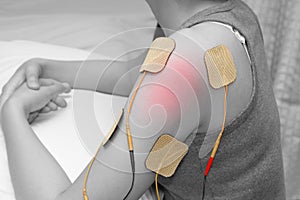 Electrodes of tens device on shoulder, tens therapy