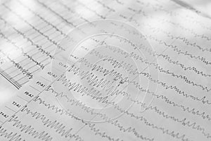 Electroencephalogram result on paper closeup, brain activity test