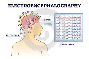Electroencephalography or EEG as brain activity monitoring outline diagram photo