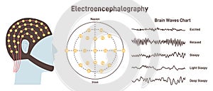 Electroencephalography. Medical test that measures electrical activity photo