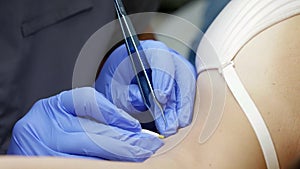 electrolysis hair removal treatment in beauty salon, closeup view of master hands and armpit of client