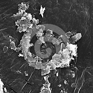 ELECTRON IMAGEN MICROSCOPY - BACTERIA ON BUGGER_MUCUS