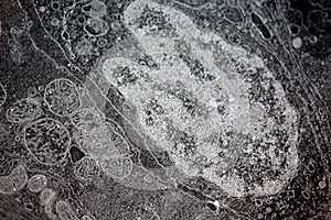 Electron micrograph of a cell nucleus