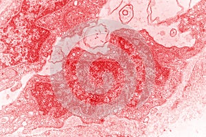 Electron micrograph of a cell nucleus