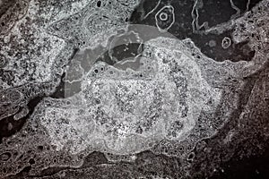 Electron micrograph of a cell nucleus